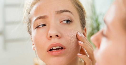 Cómo tratar la piel seca y escamosa: Consejos y Remedios Naturales